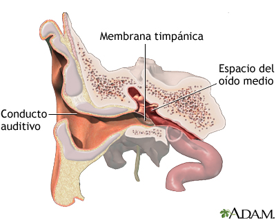 Inserción de un tubo en el oído - serie - Anatomía normal