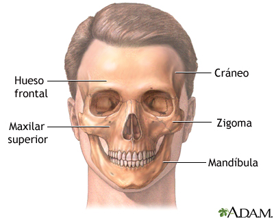 Reconstrucción cráneofacial - serie