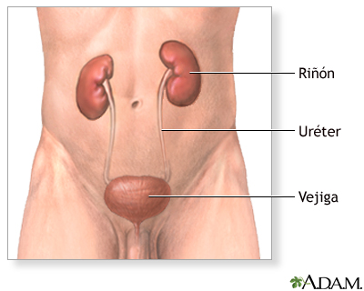 Extirpación quirúrgica del riñón (nefrectomía) - serie