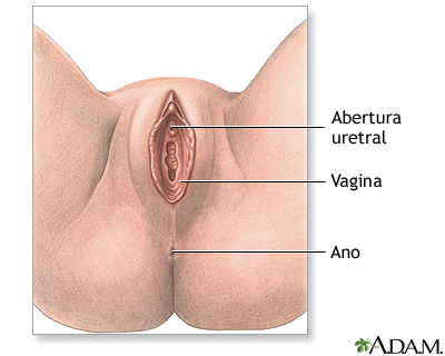Reparación anterior de la vagina (incontinencia urinaria - tratamiento quirúrgico) - serie