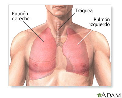 Lobectomía pulmonar - serie - Anatomía normal