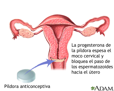 La progesterona en la píldora