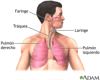 Trasplante de pulmón - serie