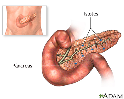 Trasplante de páncreas - serie