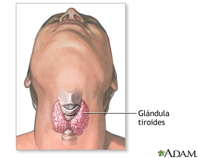 Tiroidectomía - Serie