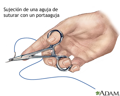 Cómo cerrar una herida por sutura