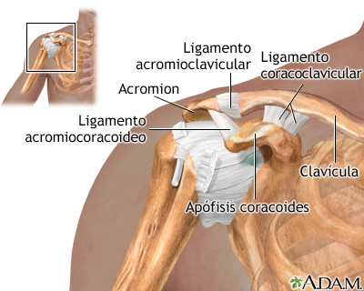 Dislocación de hombro - Serie