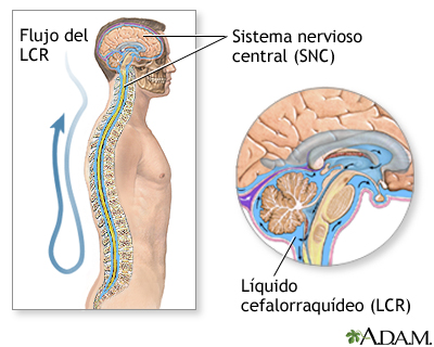 Esclerosis múltiple (diagnóstico) - serie