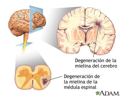 Indicaciones