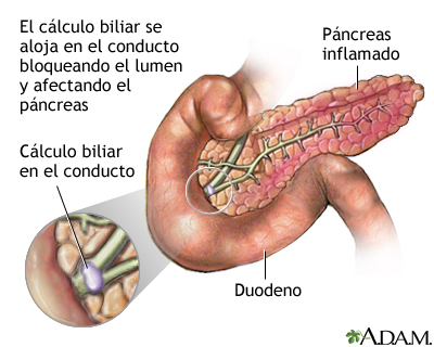 Indicaciones