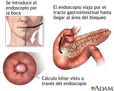 Procedimiento