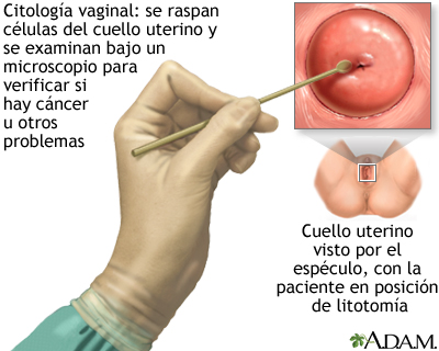Citología vaginal