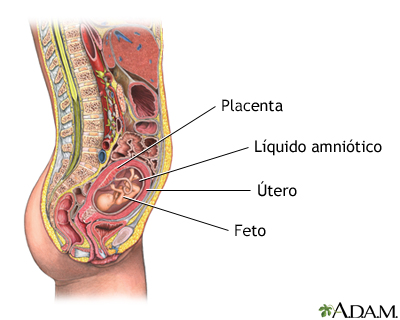 Amniocentesis - serie - Indicaciones
