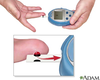 Medición del nivel de glucosa en la sangre - Calcule su nivel de glucosa