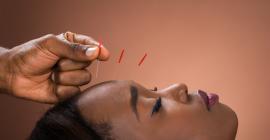 ¿Cómo ayuda la acupuntura a tratar el dolor?