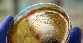 El vínculo entre bacterias intestinales y ateroesclerosis