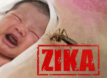 Zika: los niños tienen serios problemas de salud a medida que crecen