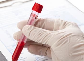 Cáncer de seno: test de sangre predice nuevos tumores