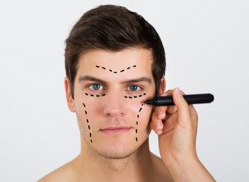 Auge de cirugías estéticas en hombres