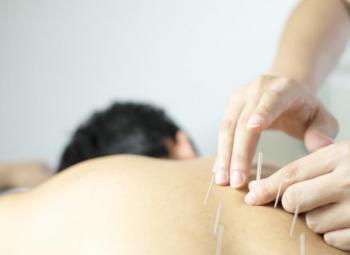 La acupuntura reduciría los sofocos de la menopausia