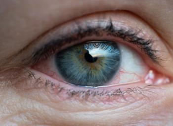 Qué es el glaucoma y cómo se previene