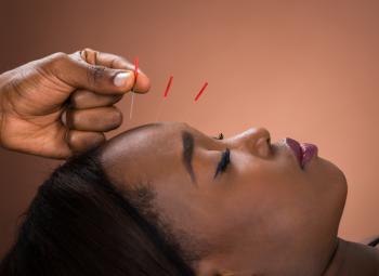 ¿Cómo ayuda la acupuntura a tratar el dolor?