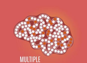 Esclerosis múltiple: mitos y verdades sobre esta afección