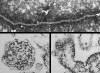 Estudio predice los virus que podrían causar la próxima pandemia  