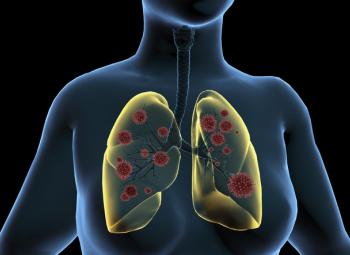 Enfermedades respiratorias agudas: cuáles son, síntomas, diagnóstico, tratamiento 