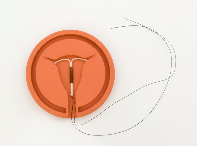 Cuáles son los mejores métodos anticonceptivos - Efectividad contra el embarazo: 99%
