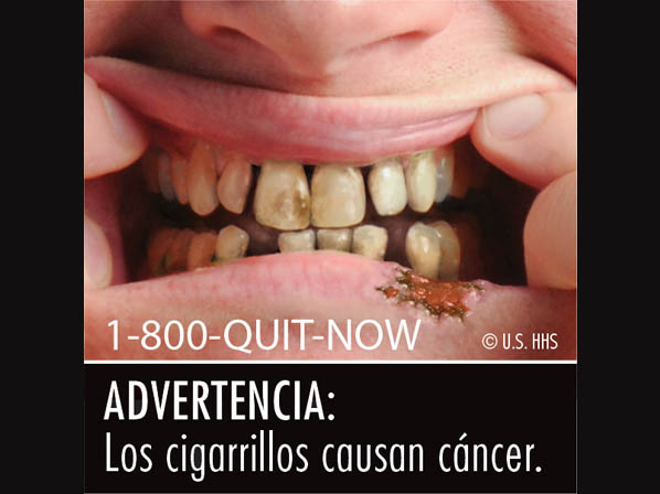 Las nueve advertencias nuevas de los cigarrillos   - 4: Los cigarrillos causan cancer
