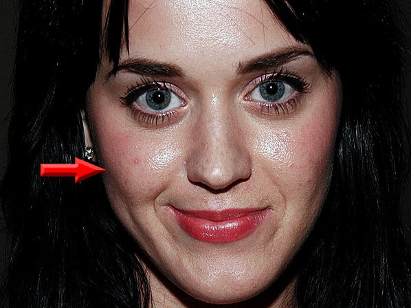 Las 15 imperfecciones que más esconden los famosos - 4. Katy Perry sufre de acné