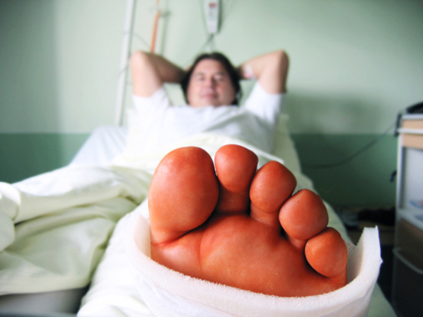 Las 12 peores lesiones del sexo - Fractura o dislocación de tobillo