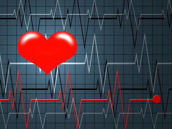 La maldición cardíaca de los Oscar  - Dos ataques: cardíaco y cerebrovascular