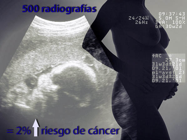 Radiación: Lo normal vs. lo fatal - 5. Radiación en el embarazo 
