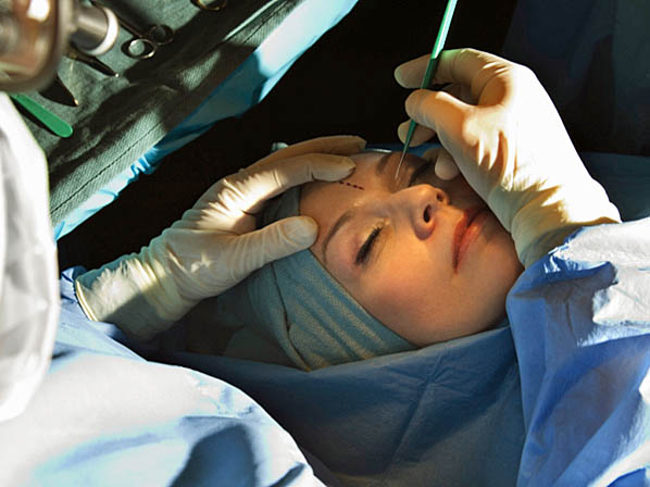 Las 10 cirugías más populares - Nº 7: Cirugía de párpados
