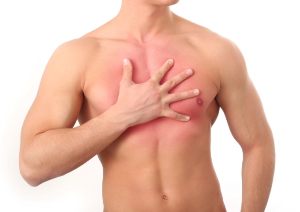10 mitos sobre enfermedades cardíacas - 3 “Sabré cuando tengo un infarto por el dolor del pecho. " 