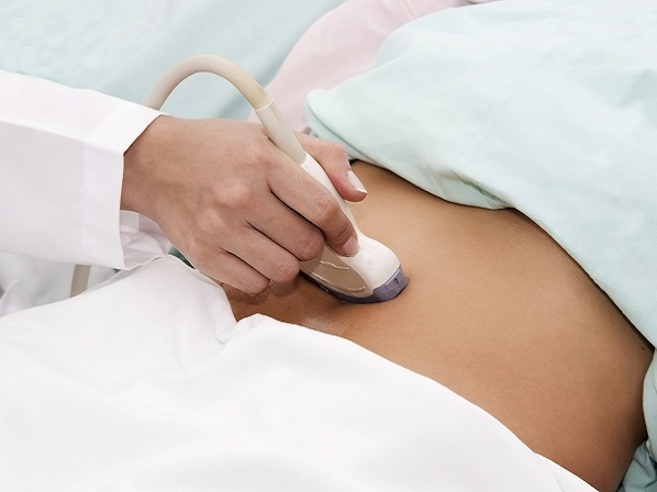 Las 10 principales causas de la infertilidad en la mujer - 9. Síndrome ovárico poliquístico