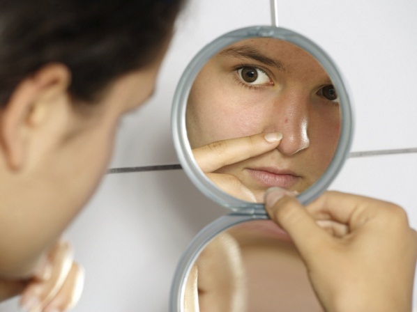 Los 10 mitos sobre el acné - Mito #7: Los granitos desaparecen al explotarlos