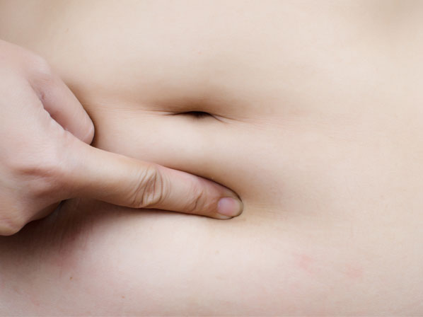 10 famosos con abdómenes firmes - ¿Qué es la abdominoplastia?