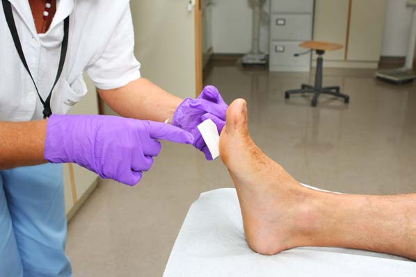 Tus pies: un espejo de tu salud  - Ulceras en los pies