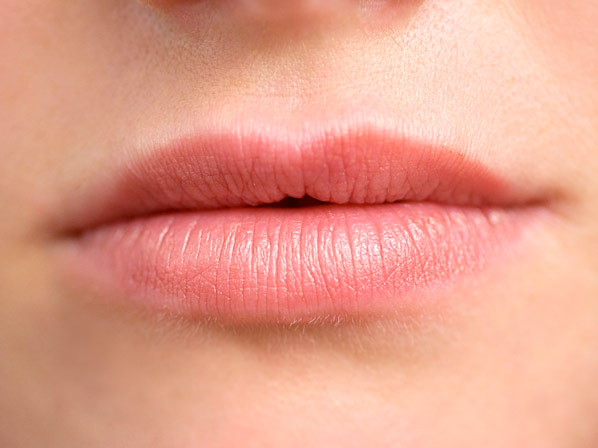 Las exóticas "imperfecciones" de los famosos - ¿Qué es el labio leporino? 