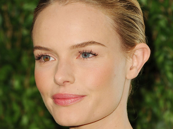 Las exóticas "imperfecciones" de los famosos - La heterocromía de Kate Bosworth