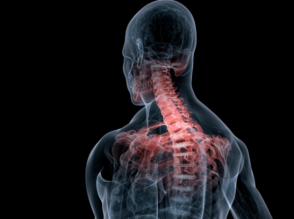 ¿Por qué nos duele la espalda? - Culpable Nº 5: las enfermedades 