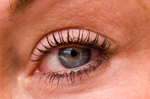 Alergias: Cómo armar un botiquín para emergencias - ¿Ojos irritados o conjuntivitis?