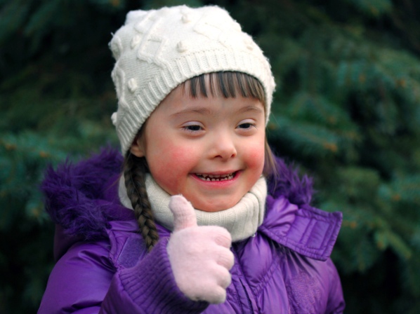 Un niño con síndrome de Down modela para despertar conciencia - Problemas mentales