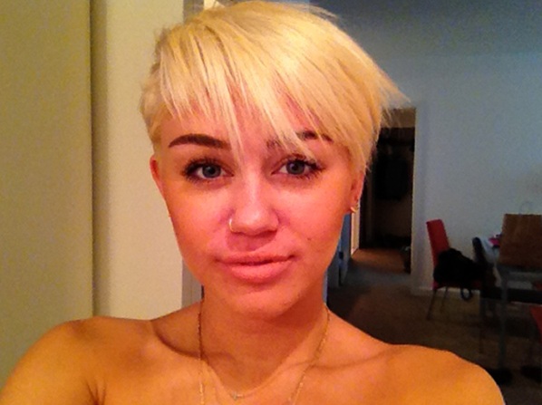 Los famosos también tienen acné - Miley Cyrus