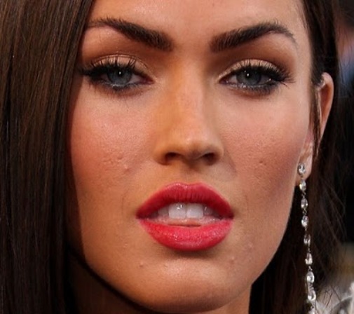 Los famosos también tienen acné - Megan Fox