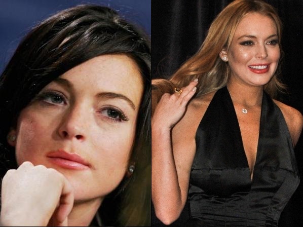 Esclavas del botox - Lindsay Lohan, una cara diferente