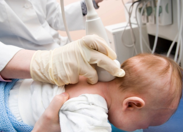 Le implantan resortes en el cráneo a un niño de 19 meses  - Una rara condición